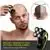 Telfun Head Shavers for Men/Women, 5-in-1 Electric Razor